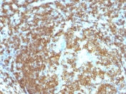IHC staining of FFPE human tonsil with CD45RA antibody (clone 158-4D3). HIER: boil tissue sections in pH 9 10mM Tris with 1mM EDTA for 20 min and allow to cool before testing.