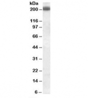 Western blot testing of Daudi cell lysate with CD45RB antibody (clone PD7/26). Predicted molecular weight: ~147/180~220kDa (unmodified/glycosylated).