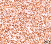 CD45RB antibody PD7/26 immunohistochemistry tonsil 20X