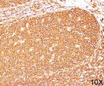 IHC testing of human tonsil (10X) stained with CD45RB antibody (PD7/26).~