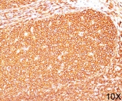 CD45RB antibody PD7/26 immunohistochemistry tonsil 10X
