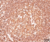 CD45 antibody 2B11 + PD7/26 immunohistochemistry tonsil 20X