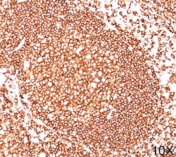 IHC testing of human tonsil (10X) stained with CD45 antibody cocktail (2B11 + PD7/26).~