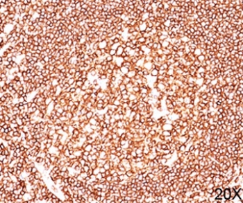 IHC testing of human tonsil (20X) stained with CD45RB antibody cocktail (2B11 + PD7/26).