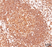 CD45 antibody 2B11 + PD7/26 immunohistochemistry tonsil 10X