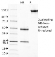 SDS-PAGE Analysis of Purified, BSA-Free RBP Antibody (clone G4E4). Confirmation of Integrity and Purity of the Antibody.