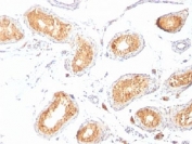 IHC staining of testis with gp100 antibody (clone HMB45). HIER: boil tissue sections in pH 9 10mM Tris with 1mM EDTA for 20 min and allow to cool before testing.