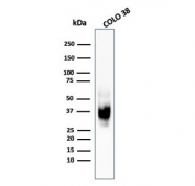 Western blot testing of human COLO-38 cell lysate with recombinant gp100 antibody (clone PMEL/1825R).