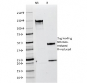SDS-PAGE analysis of purified, BSA-free gp100 antibody (clone HMB45) as confirmation of integrity and purity.