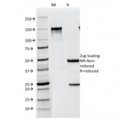 SDS-PAGE analysis of purified, BSA-free Melanoma antibody (clone NKI-beteb) as confirmation of integrity and purity.