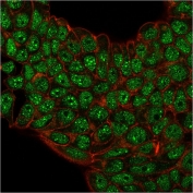 Immunofluorescent testing of PFA-fixed human MCF7 cells with SUMO2/3 antibody (green, clone SM23/496) and Phalloidin (red).