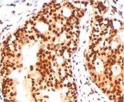 IHC staining of FFPE human tonsil with SUMO2/3 antibody (clone SM23/496).