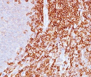IHC staining of FFPE human spleen with CD43 antibody (clone DF-T1).~