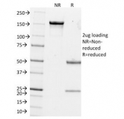 SDS-PAGE Analysis of Purified, BSA-Free Estrogen Inducible Protein pS2 Antibody (clone GE2). Confirmation of Integrity and Purity of the Antibody.