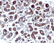 Estrogen inducible protein pS2 antibody GE2 immunohistochemistry breast cancer