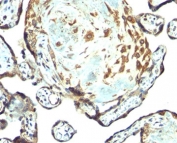 IHC staining of human placenta tissue with TIMP3 antibody.