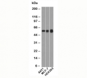 Western blot testing of human samples with p53 antibody (clone BP53-12).
