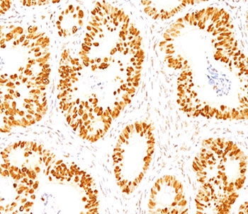 IHC staining of FFPE normal human colon with p53 antibody (clone DO-7).~
