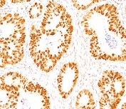 IHC staining of FFPE normal human colon with p53 antibody (clone DO-7).
