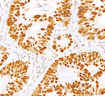 IHC staining of normal colon with p53 antibody cocktail (BP53-12 + DO-7).
