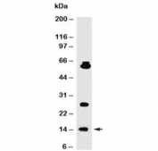 Western blot testing of human HeLa cell lysate using SUMO1 antibody (clone SM1/495).