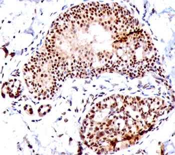 IHC staining of FFPE human tonsil with SUMO1 antibody (clone SM1/495).~