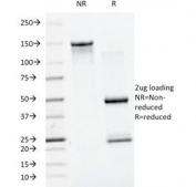 SDS-PAGE analysis of purified, BSA-free SUMO1 antibody (clone SM1/495) as confirmation of integrity and purity.