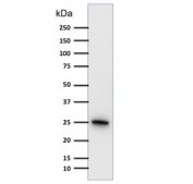 Western blot testing of human brain lysate with PGP9.5 antibody (clone 31A3). Predicted molecular weight ~25 kDa.