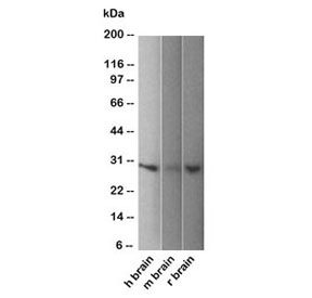 Western blot of human, mouse and rat brain lysate using PGP9.5 antibody (31A3).