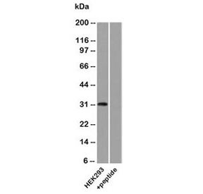 Western blot analysis of human HEK293 lysate using Uroplakin 3A antibody.