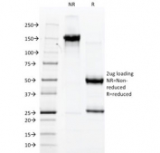 SDS-PAGE analysis of purified, BSA-free vWF antibody (clone 3E2D10) as confirmation of integrity and purity.