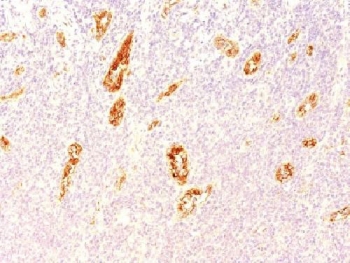 IHC testing of FFPE human pancreas tissue with vWF antibody (clone 3E2D10). Staining of formalin-fixed tissues requires boiling tissue sections in pH 9 10mM Tris with 1mM EDTA for 10-20 min followed by cooling at RT for 20 minutes.