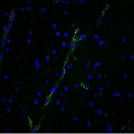 Immunofluorescent staining of human brain tissue with vWF antibody (clone 3E2D10, green) and DAPI nuclear stain (blue).