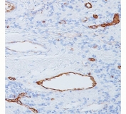 IHC staining of human tonsil with vWF antibody (clone 3E2D10). Staining of formalin-fixed tissues requires boiling tissue sections in pH 9 10mM Tris with 1mM EDTA for 10-20 min followed by cooling at RT for 20 minutes.
