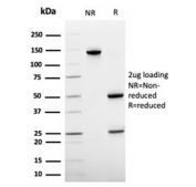 SDS-PAGE analysis of purified, BSA-free von Willebrand Factor antibody (clone VWF635) as confirmation of integrity and purity.