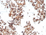 IHC staining of FFPE human pancreas tissue with Eosinophil peroxidase antibody (clone AHE-1). HIER: boil tissue sections in pH 9 10mM Tris with 1mM EDTA for 20 min and allow to cool before testing.
