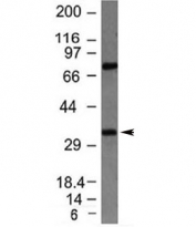 Western blot testing of HepG2 lysate with Bcl10 antibody (clone BL10/411). Expected molecular weight: 26~33 kDa.
