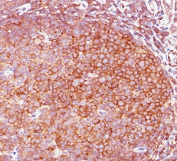 IHC staining of FFPE human tonsil with Bcl10 antibody (clone BL10/411).~