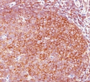 IHC staining of FFPE human tonsil with Bcl10 antibody (clone BL10/411).