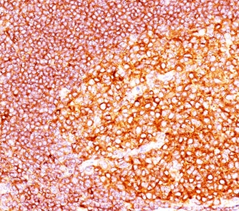IHC staining of FFPE human tonsil tissue with MALT1 antibody (clone MT1/410).~