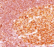 IHC staining of FFPE human tonsil tissue with MALT1 antibody (clone MT1/410).
