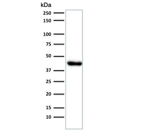 Western blot testing of human endometrium muscle lysate with Muscle Actin antibody (clone HHF35).