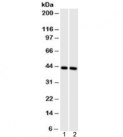 Western blot testing of 1) human muscle and 2) mouse muscle cell lysate with Muscle Actin antibody (clone HHF35).