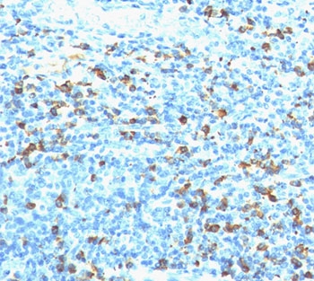 IHC staining of human tonsil with biotinylated lambda light chain antibody followed by anti-Biotin antibody (clone Hyb-8). Note cell membrane & cytoplasmic staining.~