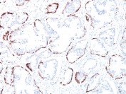 IHC staining of FFPE human prostate tissue with HMW Cytokeratin antibody (clone 34BE12). HIER: boil tissue sections in pH 9 10mM Tris with 1mM EDTA for 20 min and allow to cool before testing.