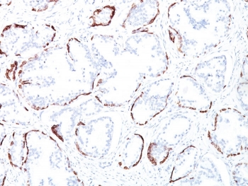 IHC staining of FFPE human prostate tissue with HMW Cytokeratin antibody (clone 34BE12). HIER: boil tissue sections in pH 9 10mM Tris with 1mM EDTA for 20 min and allow to cool before testing.~
