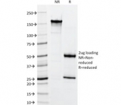 SDS-PAGE analysis of purified, BSA-free HMW Cytokeratin antibody (clone 34BE12) as confirmation of integrity and purity.