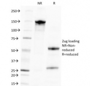 SDS-PAGE Analysis of Purified, BSA-Free CMV Antibody (clone CMV100). Confirmation of Integrity and Purity of the Antibody.