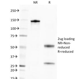 SDS-PAGE Analysis of Purified, BSA-Free Golgi Complex Antibody (clone 371-4). Confirmation of Integrity and Purity of the Antibody.