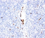 IHC staining of tonsil tissue with Granulocyte Marker antibody (clone BM-2). Note specific cytoplasmic staining.